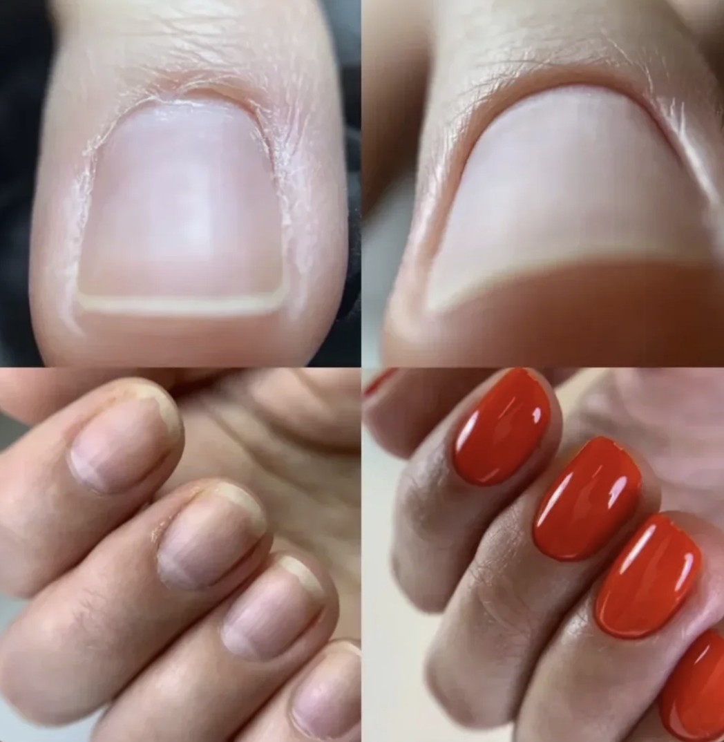 Manikura - tretman noktiju Calliope salon